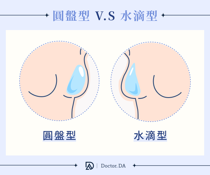 水滴型隆乳與圓盤型隆乳假體外觀與胸型差異比較