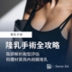 隆乳手術全攻略：醫師解析胸型評估、假體材質與內視鏡隆乳
