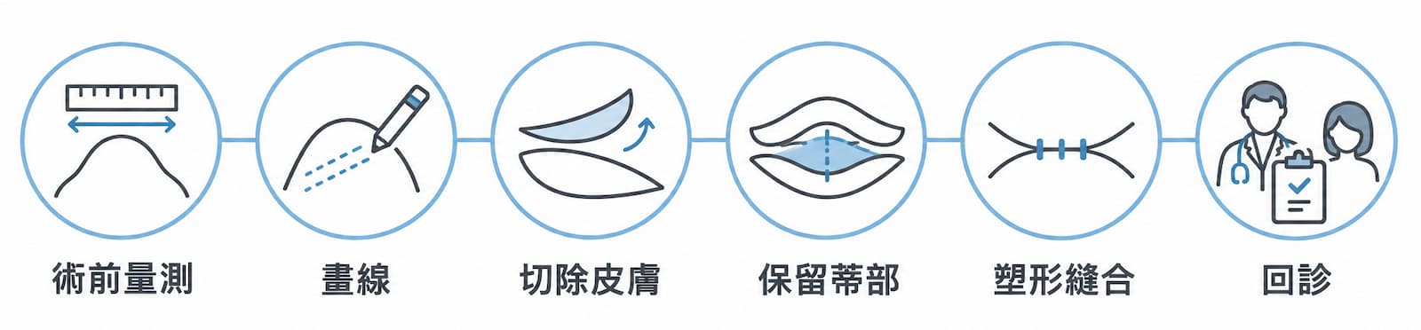 提乳手術流程與恢復期時程圖